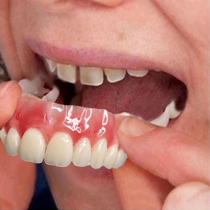 Dentadura de Silicone FIX | Ajustavel e Adaptativa Saúde & Bem-Estar (Dentaduras 1) Lojas Quinho