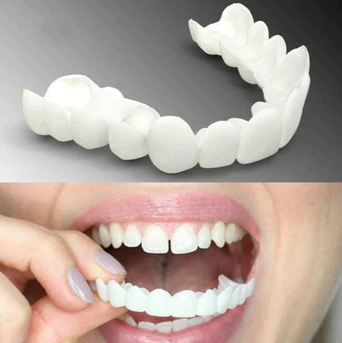 Facetas Odontológicas Removíveis Saúde & Bem-Estar (Dentaduras 2) Lojas Quinho 