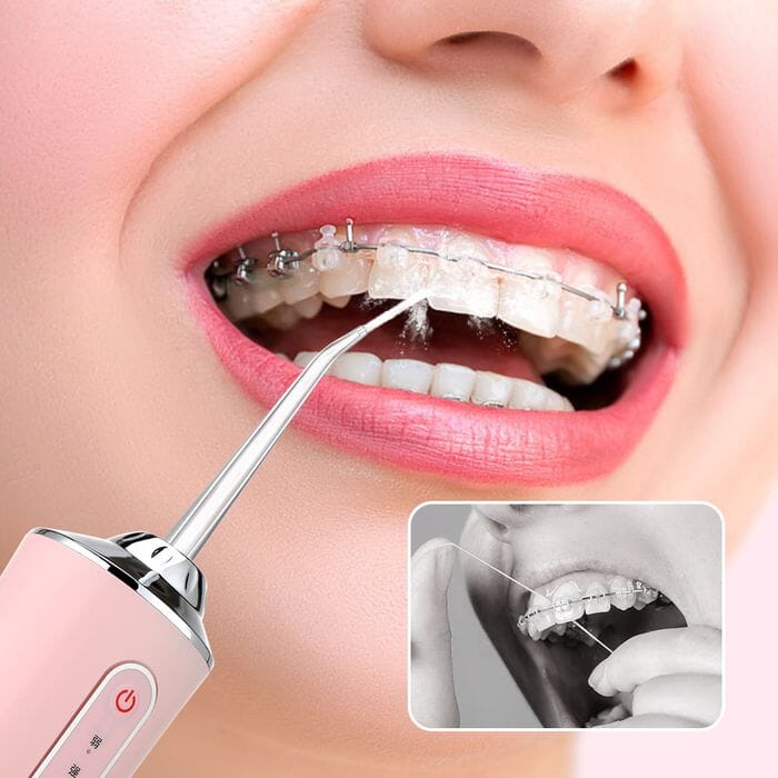 Irrigador Oral para Limpeza Bucal - CleanJet Saúde & Bem-Estar (Irrigador oral 1) Lojas Quinho