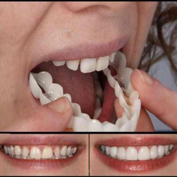 Lente de Contato Dental Removível Inferior e Superior– Resina Tooth Saúde & Bem-Estar (Lente de contato dental 1) Lojas Quinho