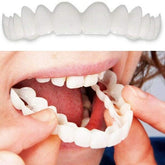 Lente de Contato Dental Removível Inferior e Superior– Resina Tooth Saúde & Bem-Estar (Lente de contato dental 1) Lojas Quinho