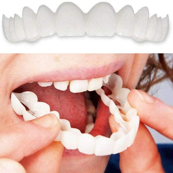 Lente de Contato Dental Removível Inferior e Superior– Resina Tooth Saúde & Bem-Estar (Lente de contato dental 1) Lojas Quinho