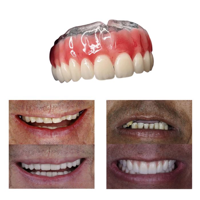 Dentadura de Silicone FIX | Ajustavel e Adaptativa Saúde & Bem-Estar (Dentaduras 1) Lojas Quinho 